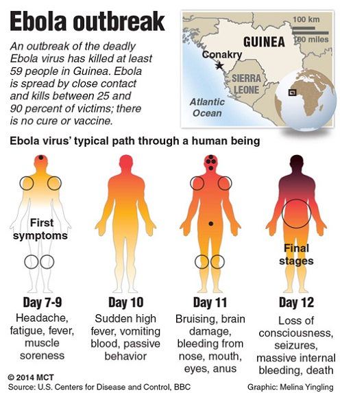 Procedura za osobe obolele od ebole